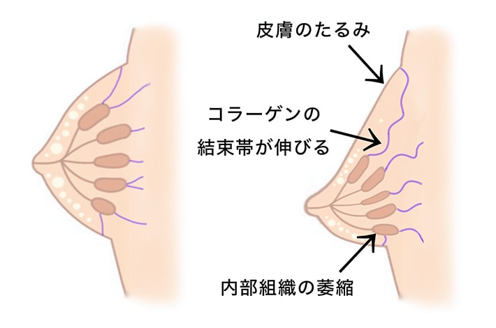 内部組織を活性