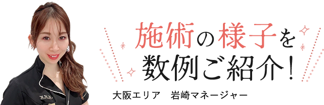 施術の様子を数例ご紹介！